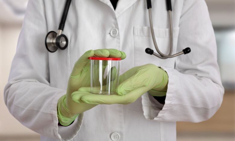 drug testing